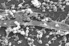 Bacteria