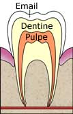 Selon la plupart des études, le blanchiment des dents n’abîme pas
								l’émail